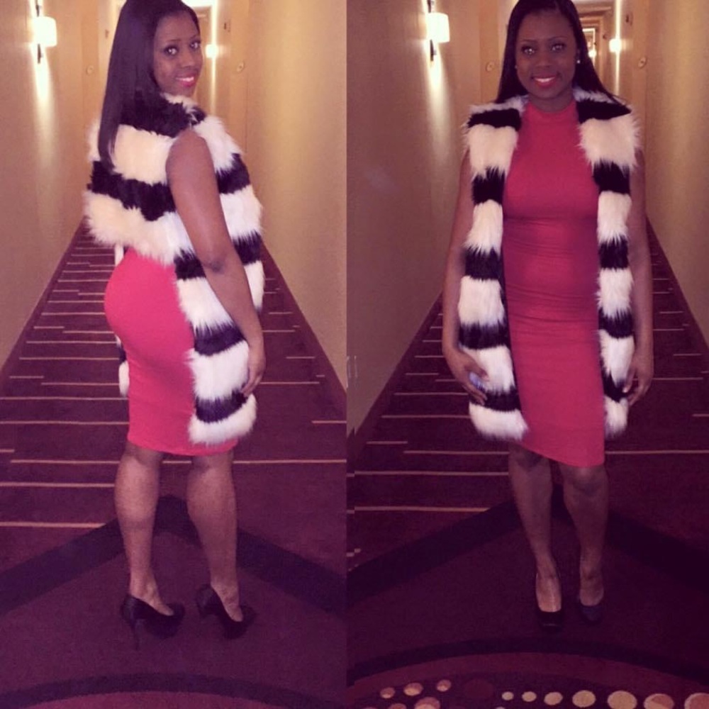 Black / White Fur Vest